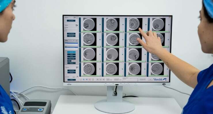 The first artificial intelligence-driven sperm selection in Cyprus